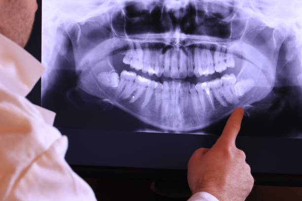 Best Emergency Dental Extractions in Wagener, SC